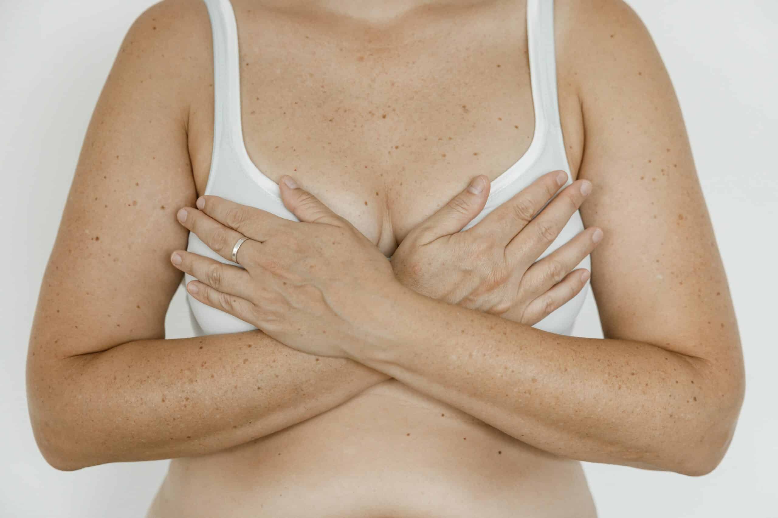 Frau hat Hängebrüste; Hängebrüste – Was kann man dagegen tun?