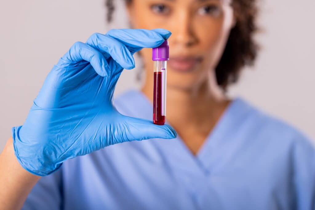 PRP Injection in Aesthetic & Plastic Surgery